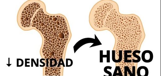 Consejos-para-mantener-la-salud-osea | SoloSalud.net Consejos para mantener la salud ósea