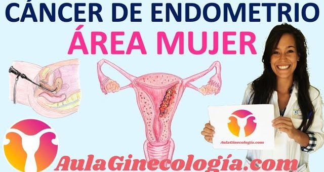 La relación entre el cáncer de endometrio y la salud ginecológica