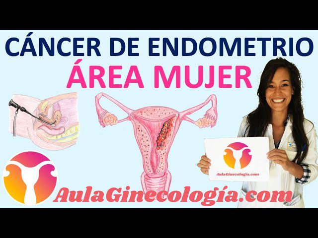 La relación entre el cáncer de endometrio y la salud ginecológica