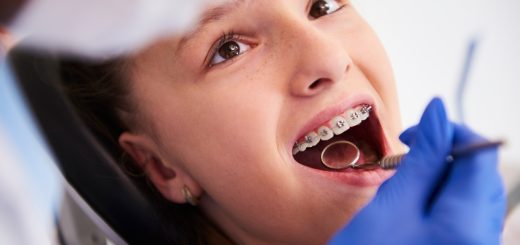 Girl with braces during a routine, dental examination | SoloSalud.net