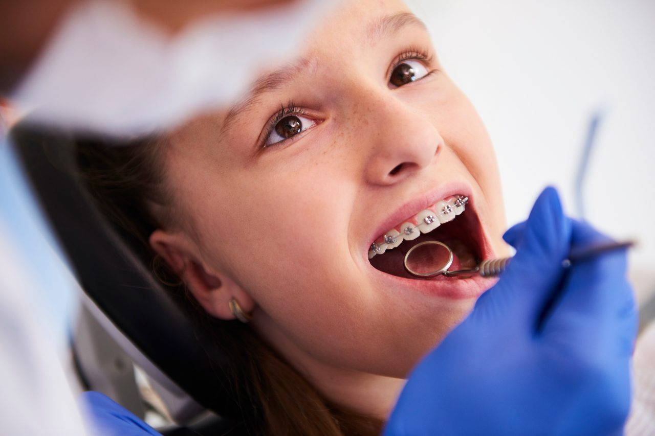 Girl with braces during a routine, dental examination | SoloSalud.net
