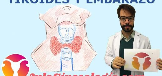 La relación entre el cáncer de tiroides y la salud ginecológica