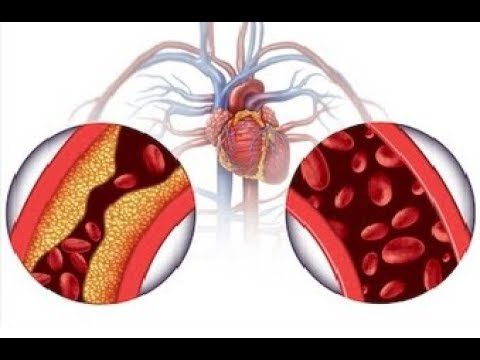 Olmesartan Medoximil