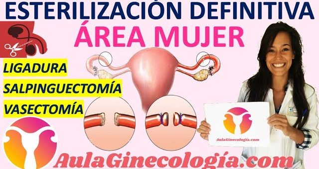 Todo lo que necesitas saber sobre la ligadura de trompas