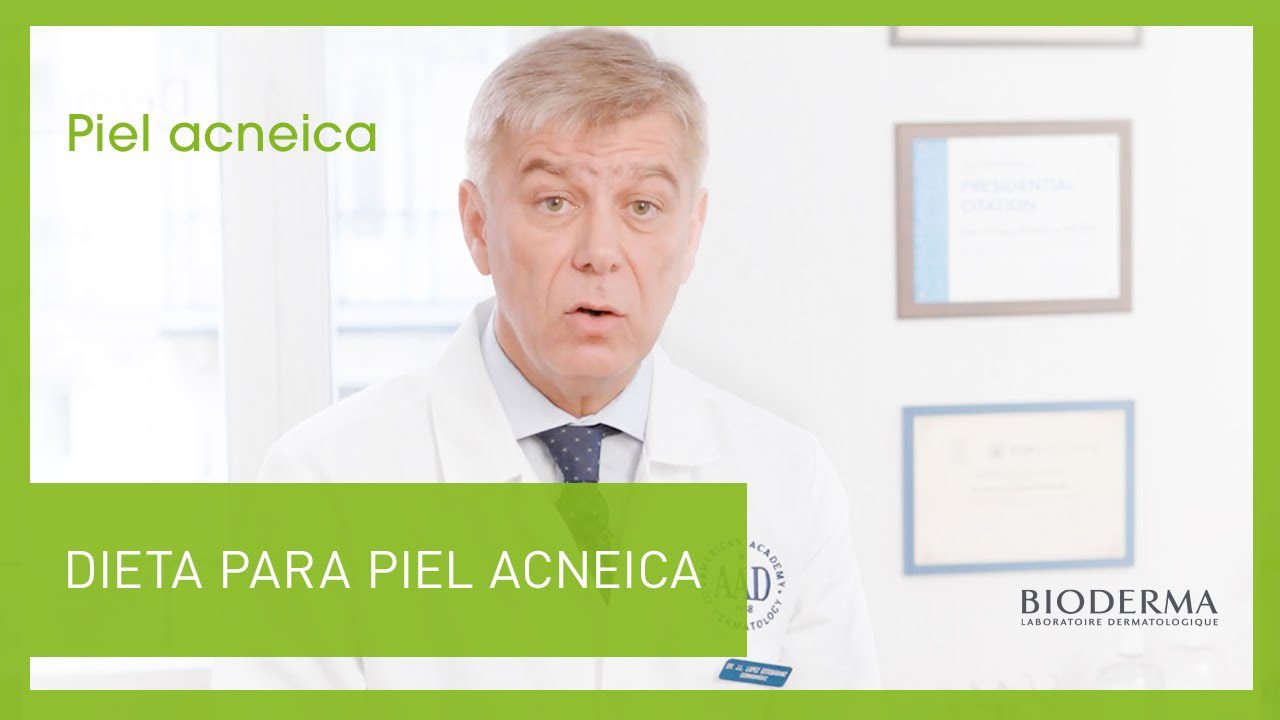 Alimentos para una piel libre de acné