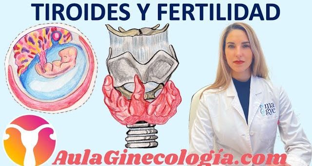 La relación entre el hipertiroidismo y la salud ginecológica