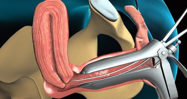 Todo lo que necesitas saber sobre la biopsia endometrial