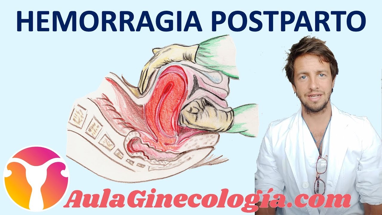 Cómo prevenir y tratar la hemorragia postparto