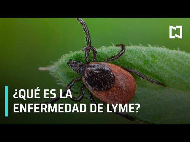 La relación entre la enfermedad de Lyme y la salud ginecológica