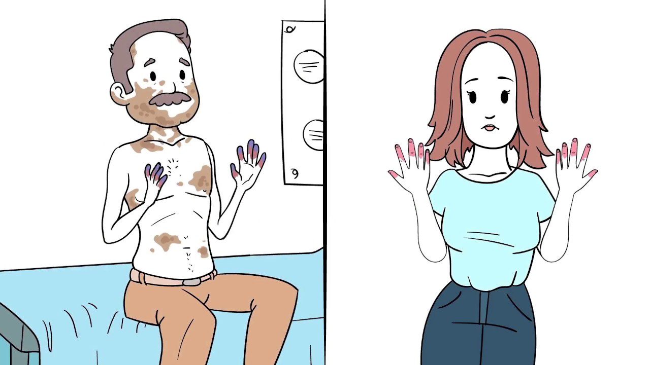La relación entre la esclerodermia y la salud ginecológica