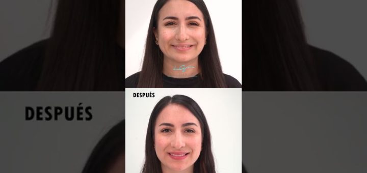 Toxina Hemaglutinina de Toxina Tipo A y otras Toxinas Tipo A