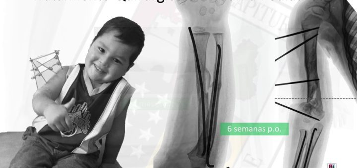 Actualizaciones en Traumatología Pediátrica: Manejo Integral de Lesiones en Niños