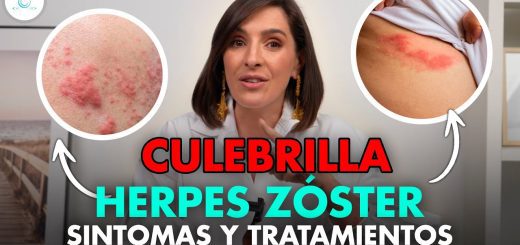 Como-prevenir-y-tratar-el-herpes-zoster-durante-el-embarazo | SoloSalud.net Cómo prevenir y tratar el herpes zóster durante el embarazo