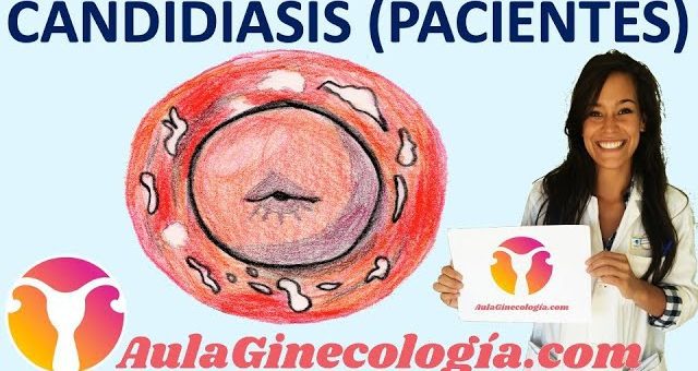 Cómo prevenir y tratar la candidiasis vaginal