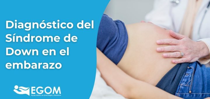 Todo sobre el seguimiento del embarazo con síndrome de Down