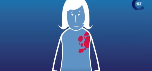 Pertuzumab | SoloSalud.net Pertuzumab