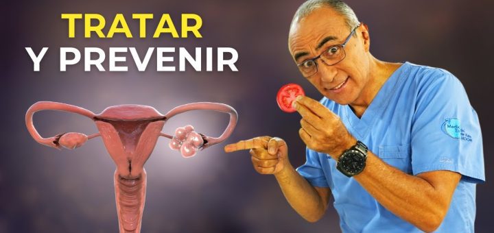 Cómo manejar el síndrome de ovario poliquístico con la alimentación