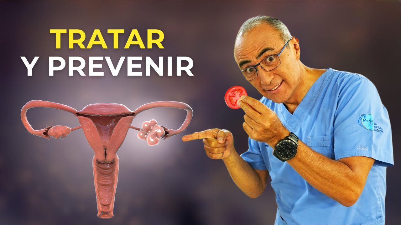 Cómo manejar el síndrome de ovario poliquístico con la alimentación