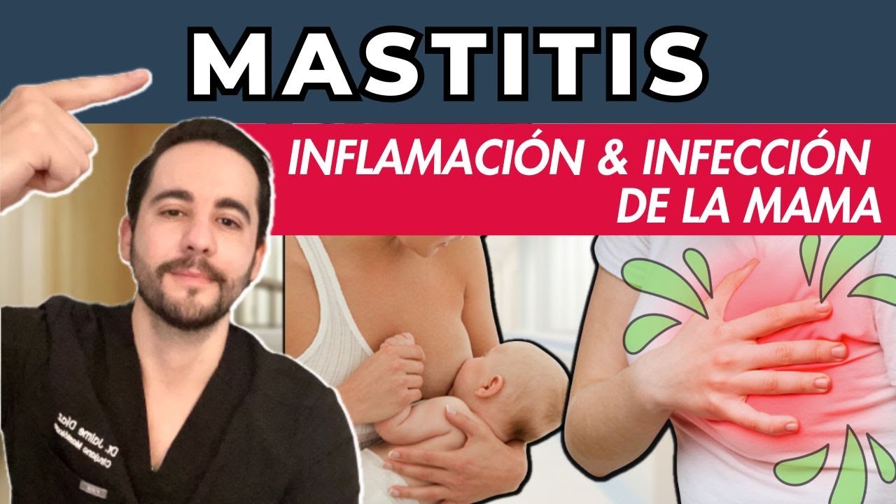 Todo sobre la mastitis y su tratamiento