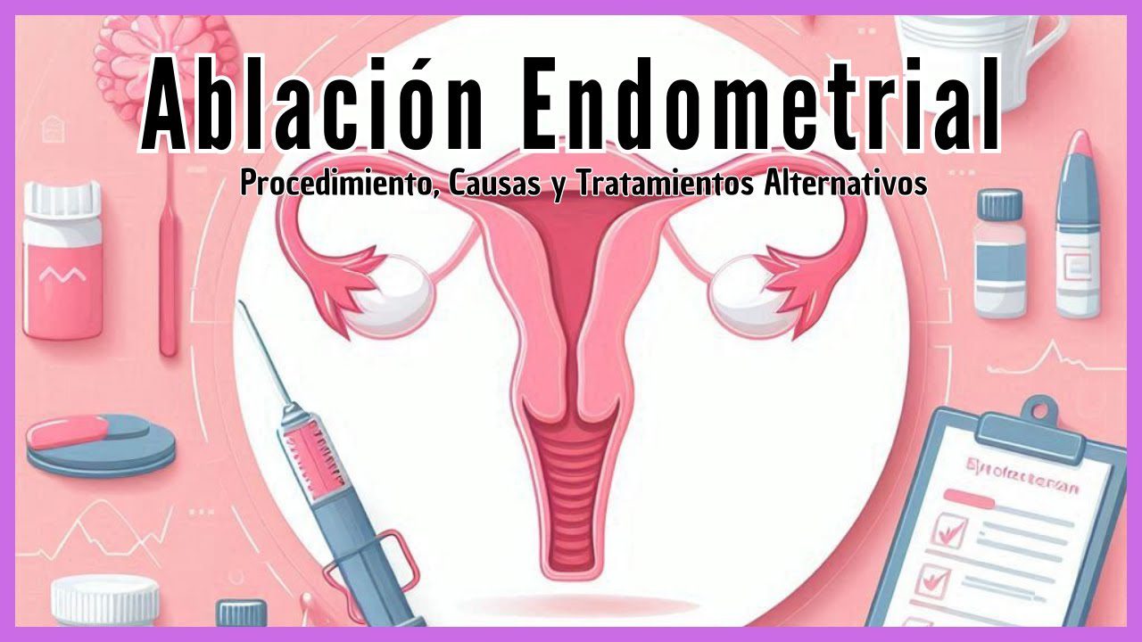 Todo lo que necesitas saber sobre la ablación endometrial
