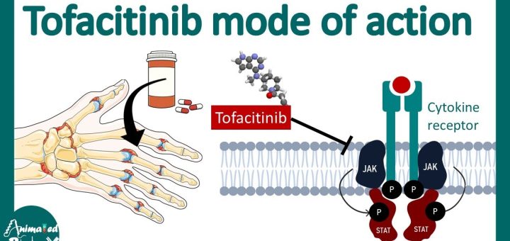 Tofacitinib