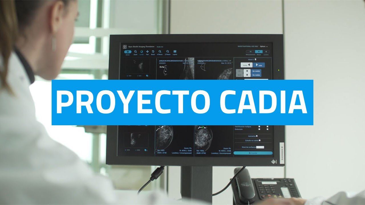 innovaciones impulsadas por Cómo funciona la IA en la detección precoz del cáncer