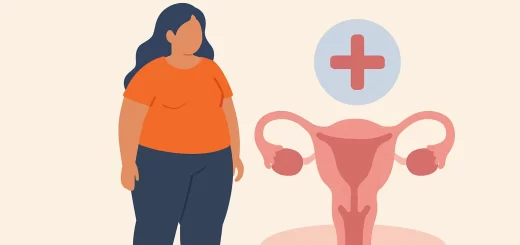 La relación entre el sobrepeso y la salud ginecológica