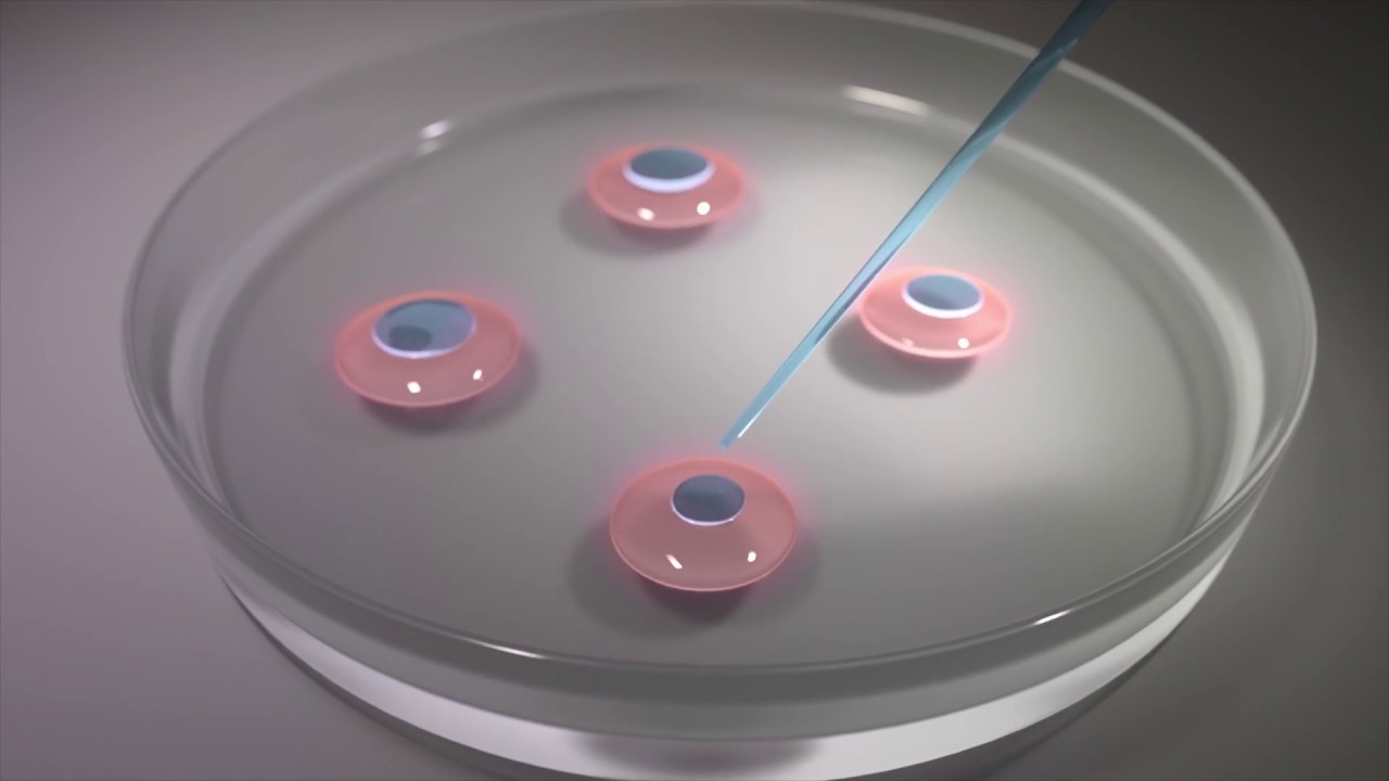 Reproducción Asistida: Avances en Tecnologías de Fertilidad