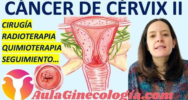Noticias en Ginecología Oncológica: Avances en el Tratamiento del Cáncer Ginecológico