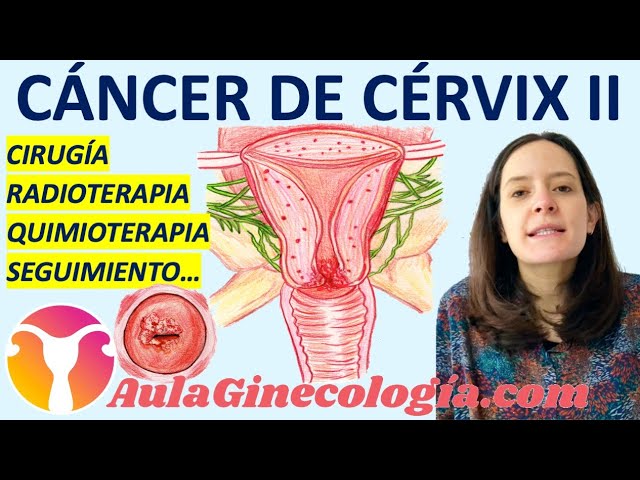 Noticias-en-Ginecologia-Oncologica-Avances-en-el-Tratamiento-del-Cancer-Ginecologico | SoloSalud.net Noticias en Ginecología Oncológica: Avances en el Tratamiento del Cáncer Ginecológico
