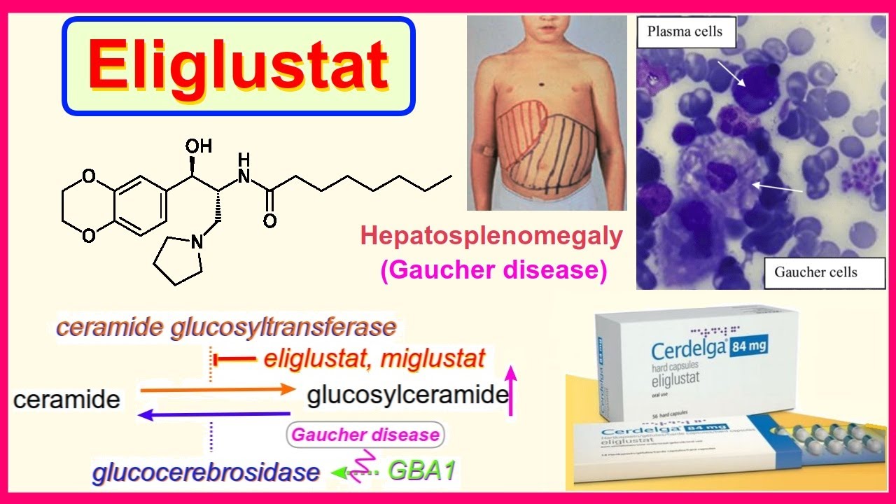 Eliglustat