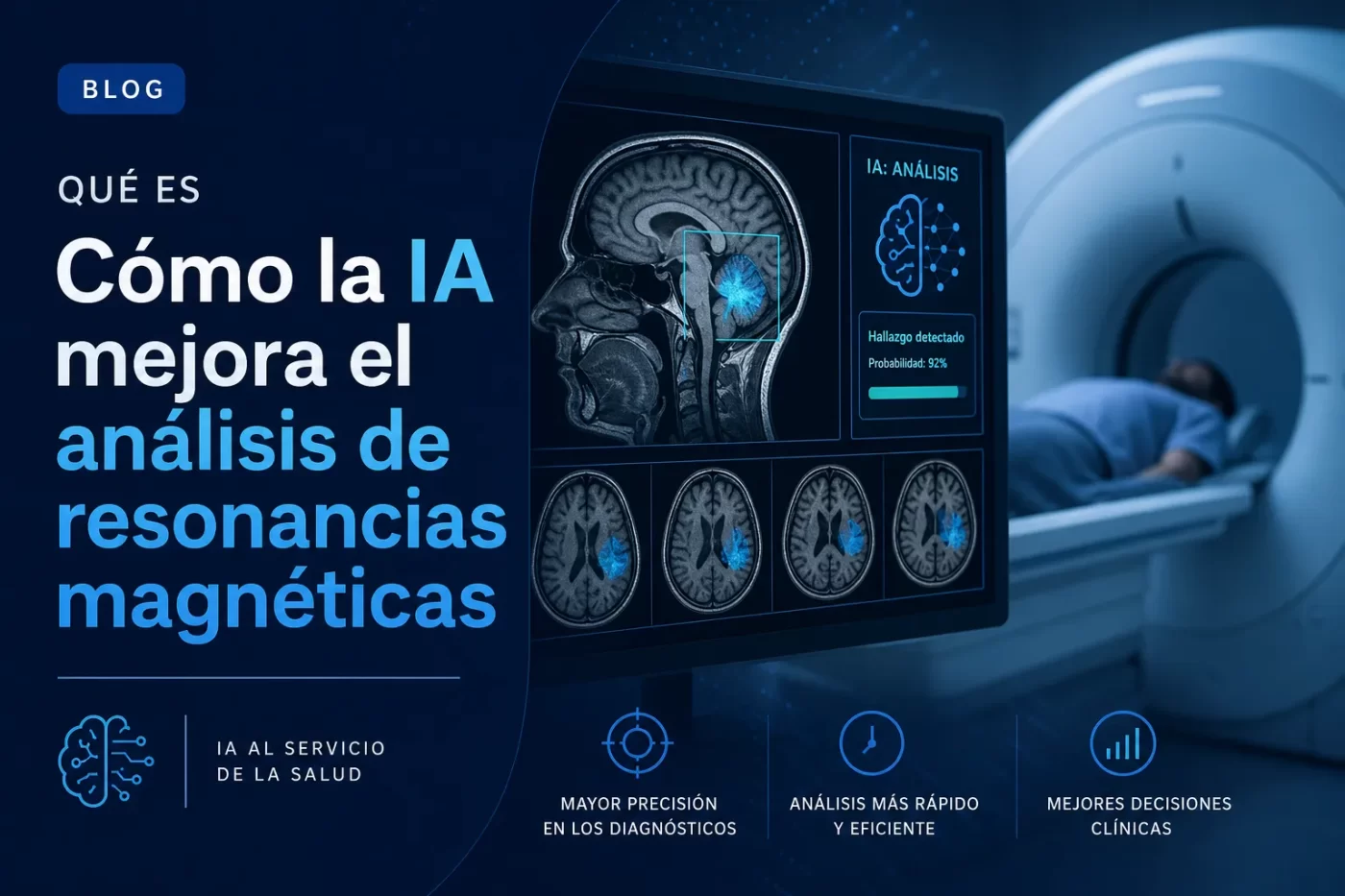 que-es-Como-la-IA-mejora-el-analisis-de-resonancias-magneticas | SoloSalud.net qué es Cómo la IA mejora el análisis de resonancias magnéticas